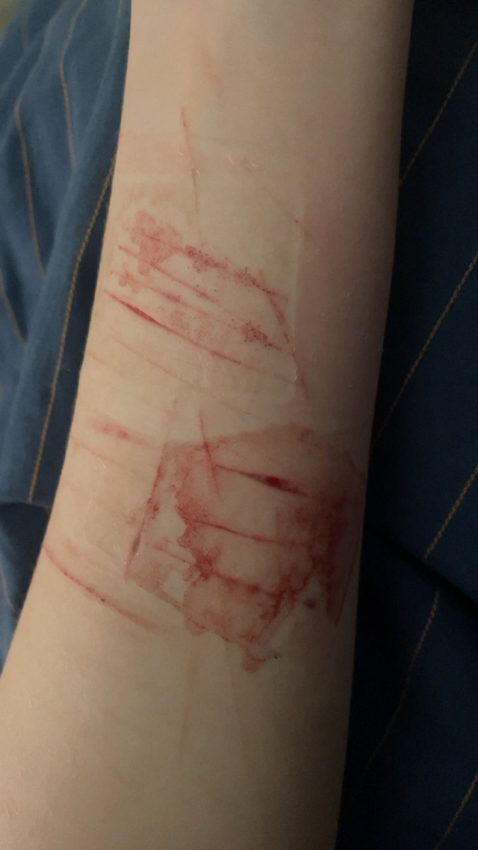 ccrrooccoo7's tweet photo. month difference btw #slittwt #shedtwt #shtwt FAKE FAKE FAKE FOR ART CLASS FAKE FAKE (lwk was in the mental ward for a bit thats why i was offline) https://t.co/2vNsbJk40y