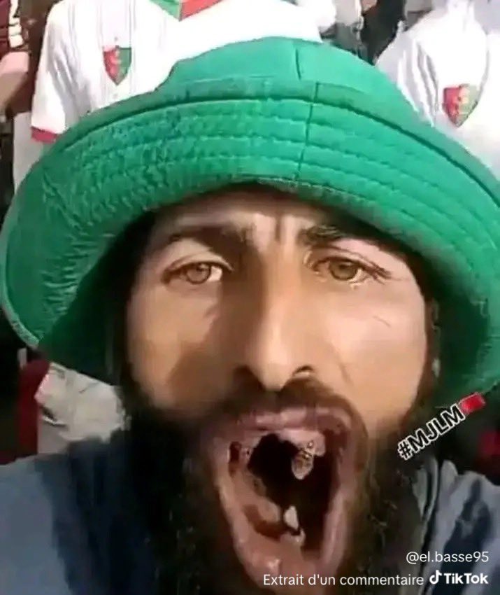 MeuzDeep's tweet photo. @i_xhalil @Neymarmed10 https://t.co/RzP9yms0Sh