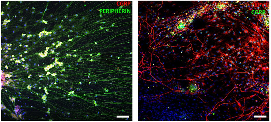 ESC_iPSC_News's tweet photo. Recently published in @stemcellreports!💡
Researchers develop a highly efficient method to generate CGRP-expressing peptidergic nociceptors from human #iPSCs, creating a robust platform for pain research and drug discovery.
🔖 https://t.co/L76trEApKS https://t.co/VJnCWOheQn