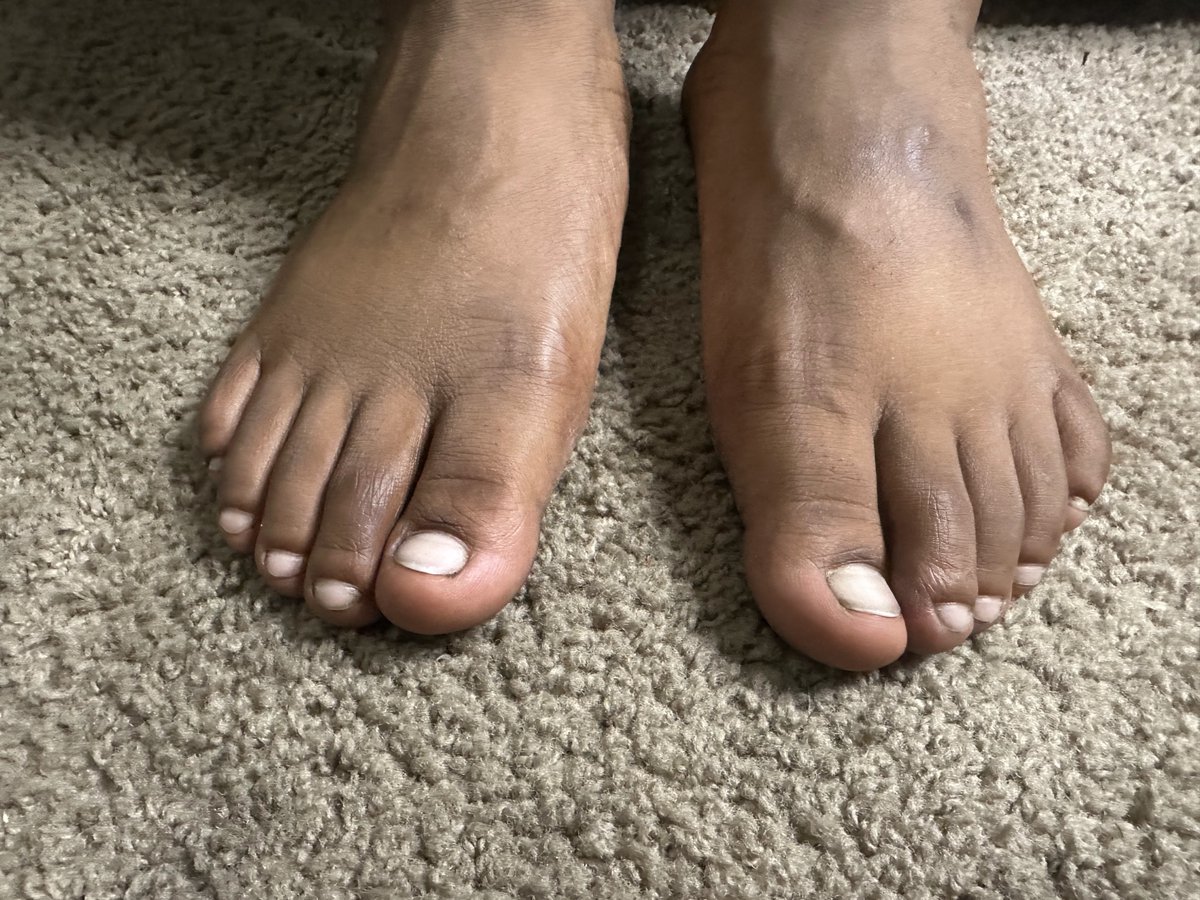 TheManCaveMS's tweet photo. Follow and support the IG @mancavemalesalon

#pedicure #feet #mancave #mancavellc #mancaveexperience #uglyfeet #manfeet #prettyfeet #manicure #fyp #nailart #blackmanfeet #blackman #ebonyfeet #toes #soles #foot #nails #blackmalefeet #blackmale #fyp #pov https://t.co/69jeEB0aKB