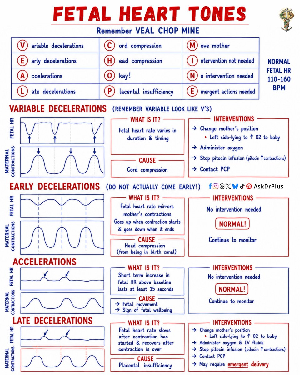 AskDoctorPlus's tweet photo. Fetal Heart Tones:
Their causes, and remember the correct interventions with confidence.
#FetalMonitoring #FetalHeartTones #NCLEX #Obstetrics #askdrplus https://t.co/TUqfRtaWne
