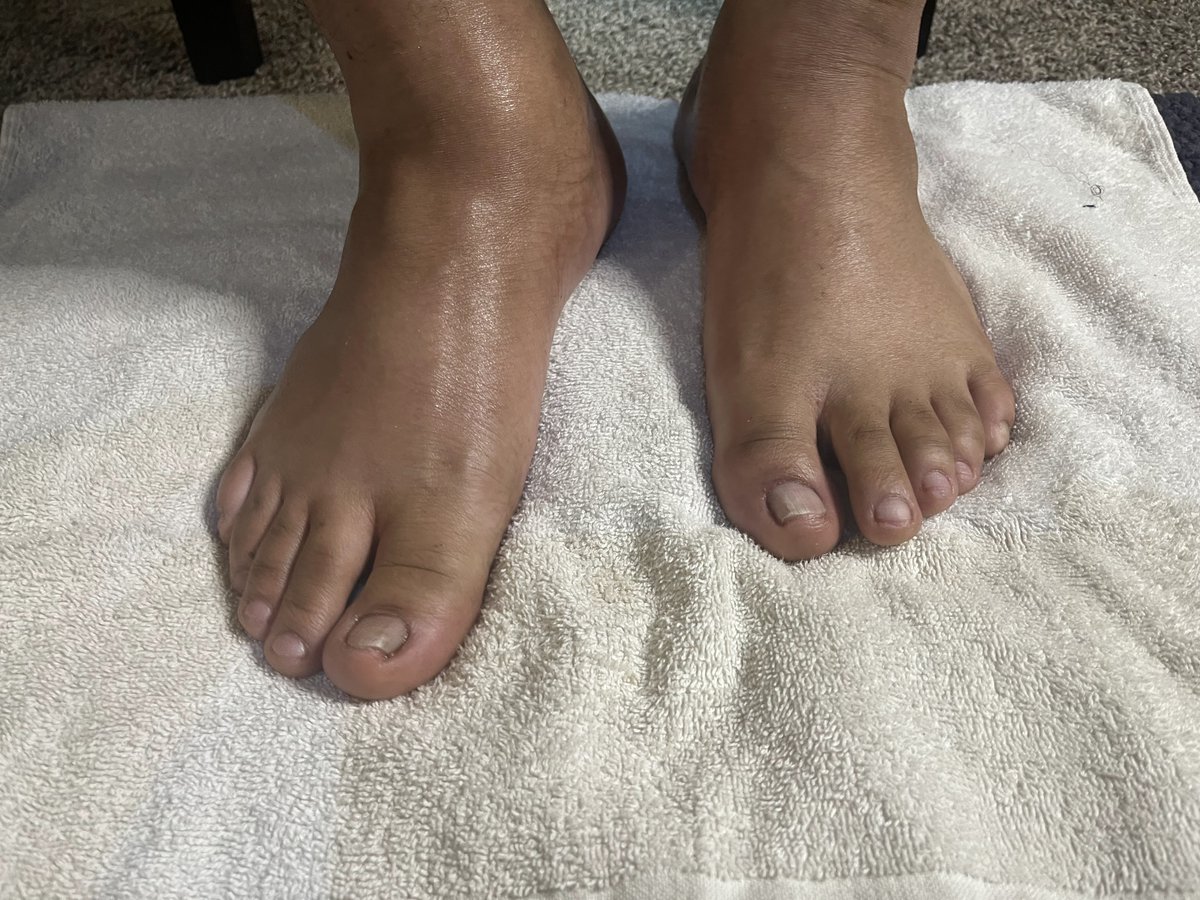 TheManCaveMS's tweet photo. Follow and support the IG @mancavemalesalon

#pedicure #feet #mancave #mancavellc #mancaveexperience #uglyfeet #manfeet #prettyfeet #manicure #fyp #nailart #blackmanfeet #blackman #ebonyfeet #toes #soles #BlackOwned #foot #nails #blackmalefeet #blackmale #fyp #pov https://t.co/LgucprLaMt