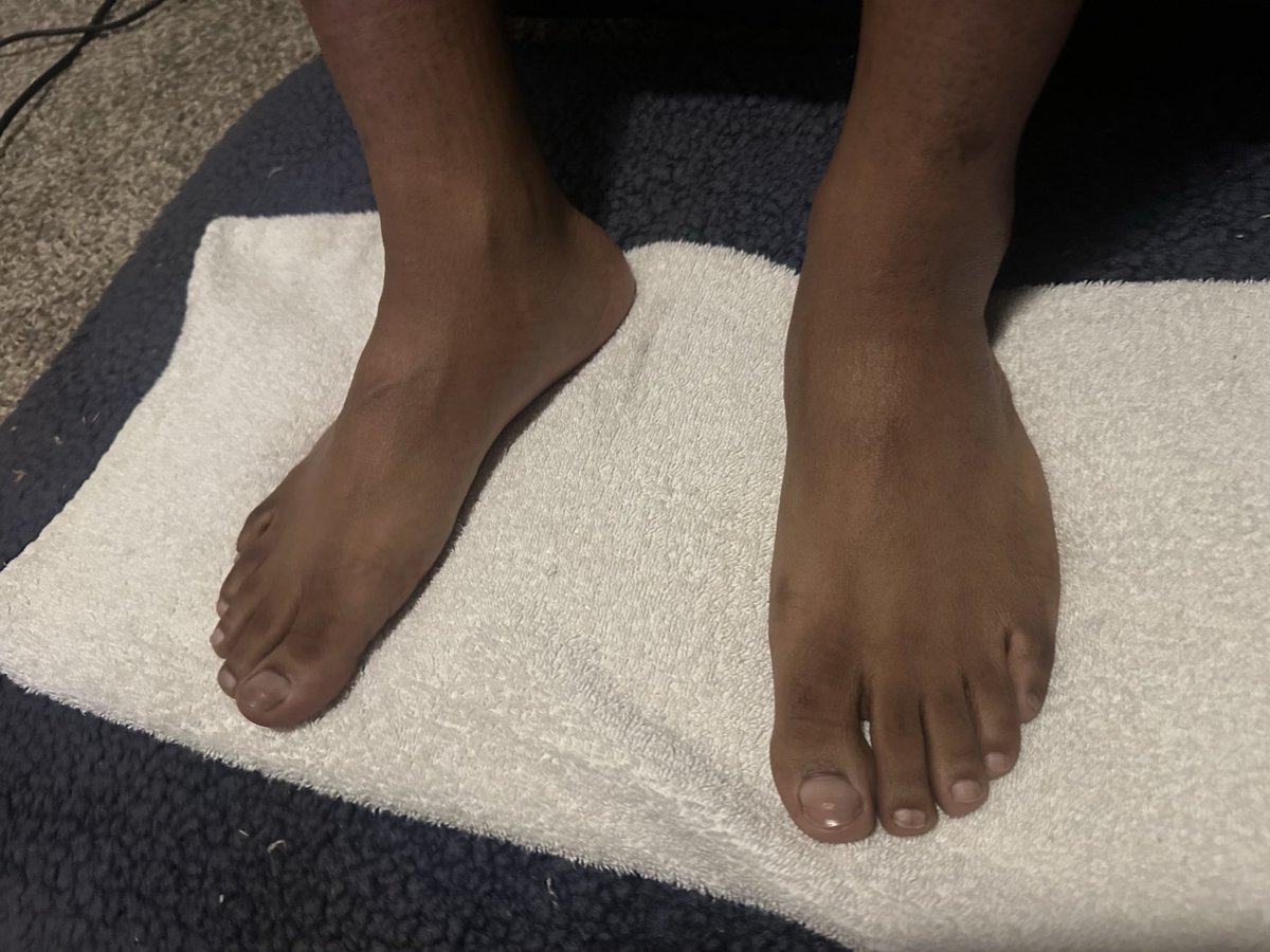TheManCaveMS's tweet photo. Follow and support the IG @mancavemalesalon

#pedicure #feet #mancave #mancavellc #mancaveexperience #uglyfeet #manfeet #prettyfeet #manicure #fyp #nailart #blackmanfeet #blackman #ebonyfeet #toes #soles #BlackOwned #foot #nails #blackmalefeet #blackmale #fyp #pov https://t.co/SHRxqhtB7A