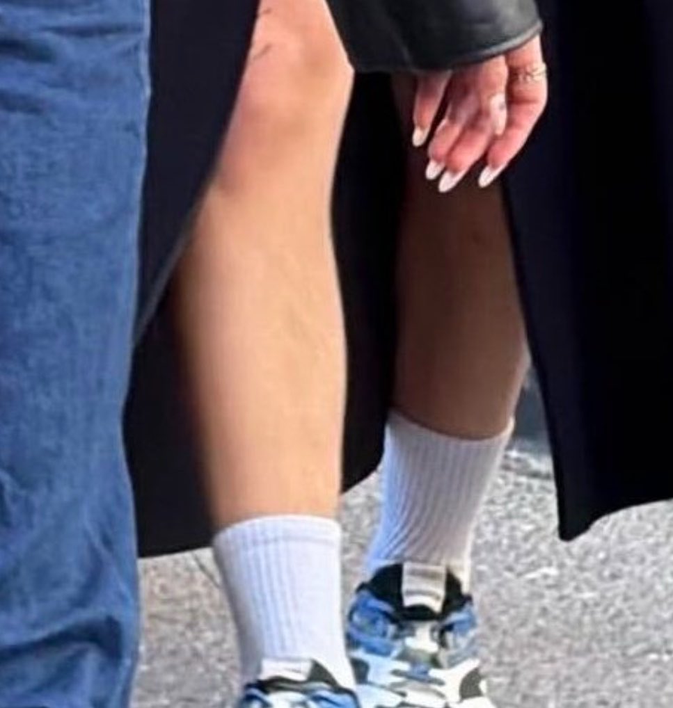 hudglaze's tweet photo. his babydoll legs https://t.co/vnpg2LKiSF