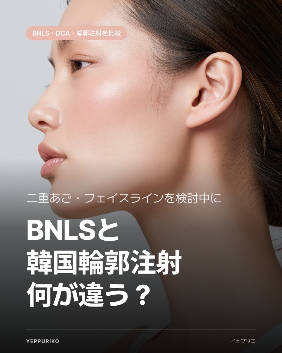 yeppuriko's tweet photo. 日本でBNLSを打ち続けてるのに、なかなか変わらない……これ、知らないと損かもしれない。

韓国の最新「輪郭注射」、成分も価格も実は別次元の話なんだよね。

✅ まず価格の差がリアルにすごい
日本のBNLSは1ccあたり¥4,000〜¥8,000程度。
韓国だとフェイスライン全体のパックが₩50,000〜₩150,000くらいから（2025年時点・クリニックにより異なります）。
同じ量を日本で受けると、数万円オーバーになるケースも。

✅ でも「安ければOK」じゃない
韓国では「ステロイドフリー」かどうかがクリニック選びの重要な基準になってる。
ステロイン入りの注射はホルモンバランスへの影響や不正出血のリスクが一部で指摘されているから、カウンセリングで確認しておくと安心。

✨ 二重あごが気になるならDCAに注目
デオキシコール酸（DCA）主成分の注射は、脂肪細胞そのものへアプローチする仕組み。
米国FDAでも承認された成分で、リバウンドしにくいとされています（個人差あり）。

エラボトックスとのセットで対応しているクリニックも増えているみたい。

韓国美容のリアルな情報、毎週届けてます。気になった方はフォロー＆保存してね💾