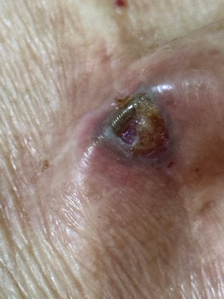 bwlygs's tweet photo. 🆘 AYUDA URGENTE 🆘

se puso en contacto conmigo una amiga pidiendo por favor le ayude a difundir, luego del terremoto a su abuela el marcapasos le empezó a fallar nuevamente, ya tenía tiempo así pero ahora está peor. necesita con urgencia operarse, y no tienen cómo costearlo https://t.co/1mvyCGRruc