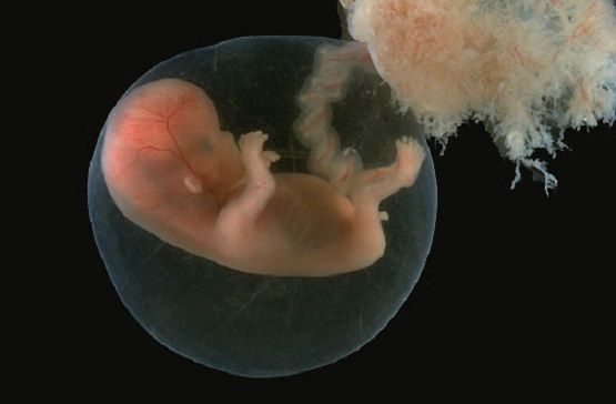 LifeNewsHQ's tweet photo. Abortion Kills 20,000 Jewish Babies in Israel Every Year https://t.co/JwLMPHATob https://t.co/1cuSd59qJ0