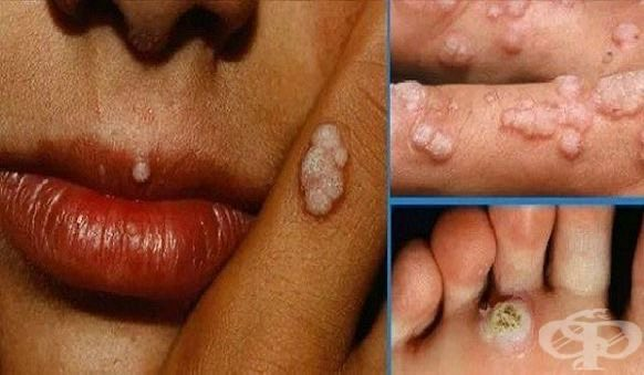 WhosM19's tweet photo. ESTÁS SON LAS ENFERMEDADES MÁS COMUNES QUE SE TRANSMITEN AL TENER S3X0.

1. EL VIRUS DEL PAPILOMA HUMANO. https://t.co/rm7ArPaov1