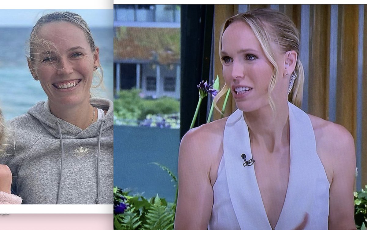 MajorCelebrity's tweet photo. #Wimbledon2026 What the heck happened to #CarolineWozniacki? She looks like a 60-year-old #skeleton! A year ago on the left & today on the right. She now has #faketeeth, a #fakenose, & lost about 50 lbs! Why? She was a cute girl; now she looks like a #RealHousewifeofTransylvania! https://t.co/g2jNmo3O08