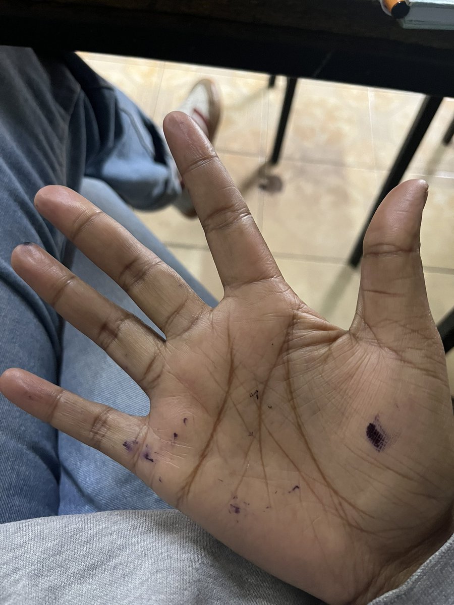 kigutasheilaa's tweet photo. My pen is not leaking so I don’t understand why I have ink spots all over. https://t.co/IIpUgQ4Vg1
