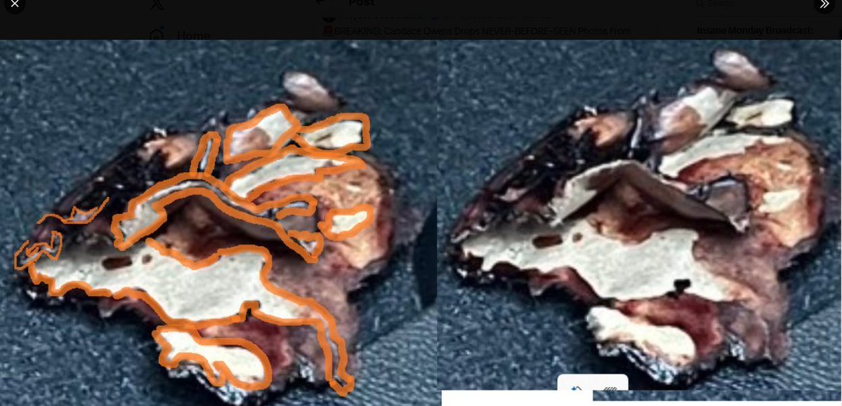 Panelshell's tweet photo. @michael_vina27 Until these clearer images came out, I could not see this as a lithium ion battery, and NOW I CANNOT UNSEE the silvery layers and edges folded, bent, charred! Clip a good image and zoom in. Recognize the color of your LO phone battery &amp; one that has swelled and split. I do. https://t.co/m6VXAPa2RL