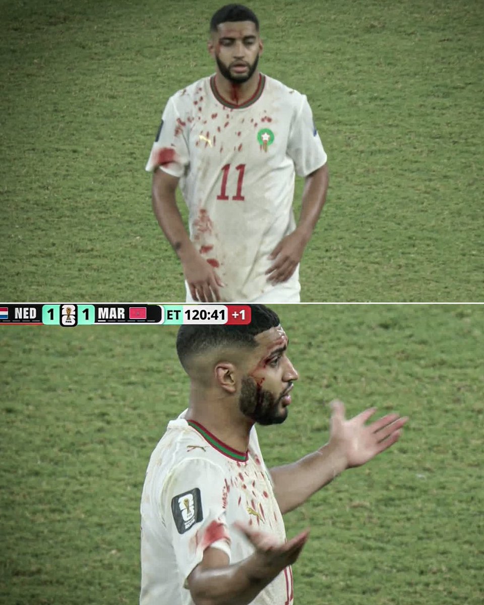 ESPNFC's tweet photo. Saibari after a collision in extra time 😲 https://t.co/cqGGgaIVoj