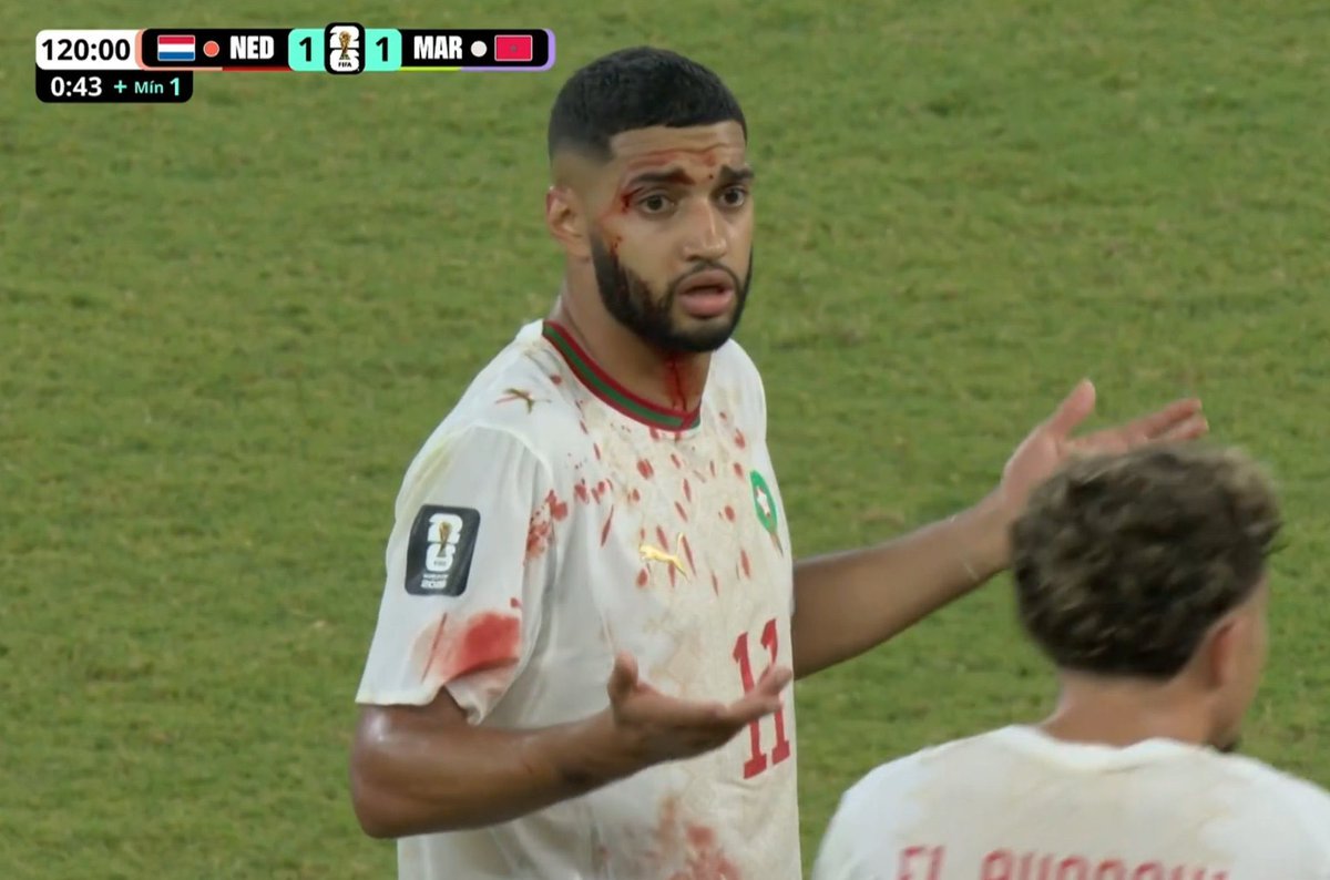 belleprsnn's tweet photo. bro looks as confused as me. when did he even get injured https://t.co/6Qg5Lz2Mvt