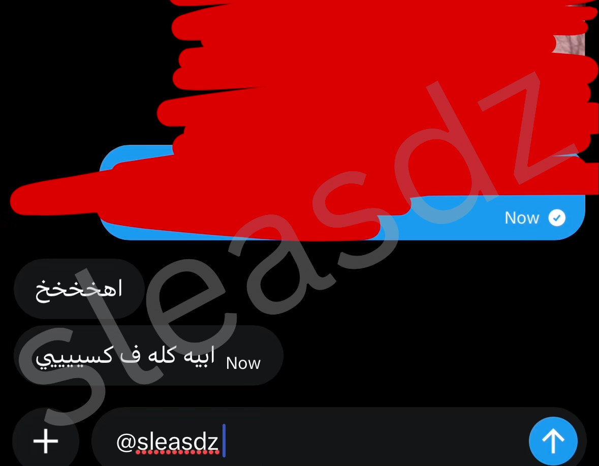 sleasdzs's tweet photo. بقرتي المستشرفه رقم ١٠٤ نزلت في ٦ دقايق، المحلوبه اللي بعدها🐄🦶🏻 #معصيتي_رحتي https://t.co/Ai349xcRui