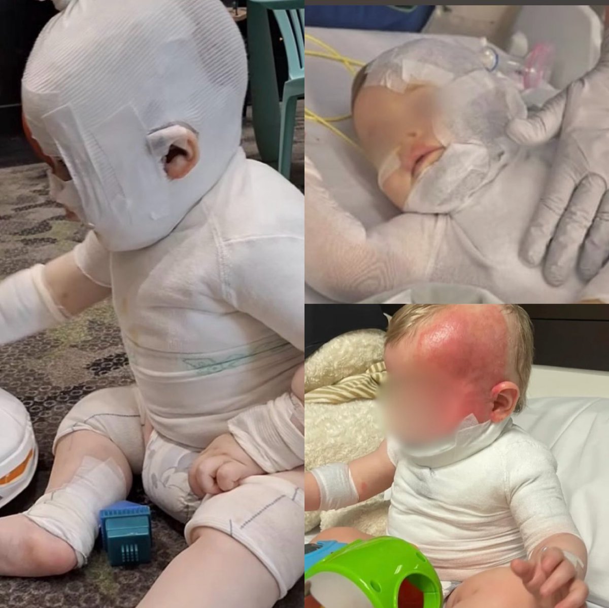 TruthFairy131's tweet photo. You want to talk about ‘racism’ 🤨

A Chinese immigrant hunted down WHITE nine month old baby boy named Luka because he said he wanted to harm a White person.

He intentionally poured boiling hot coffee over baby Luka which burnt a large portion of his face & body.

White girls & women are being hunted down by migrants in Australia & all across the West & are being raped & killed because they are WHITE.

Meanwhile the government is focused on those that speak up about Antiwhiteism & protecting our women & children.

Truly evil & unacceptable. 

So, please excuse me if I don’t give a crap about so called ‘offensive words’ or the ‘feelings’ of those offended by literally everything 😡