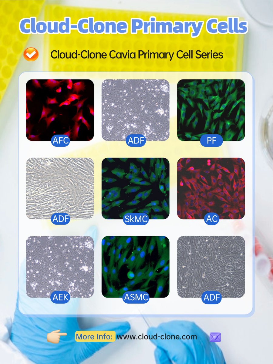 Cloud_CloneCorp's tweet photo. ✨Cloud-Clone Cavia Primary Cells Recommendation 👍Cloud-Clone Corp. has launched a full series of guinea pig primary cells covering ‌12 tissue sources‌, providing critical tools with ‌clear origin and strict quality control‌ for related biomedical research. https://t.co/fV5Z6r6uWK