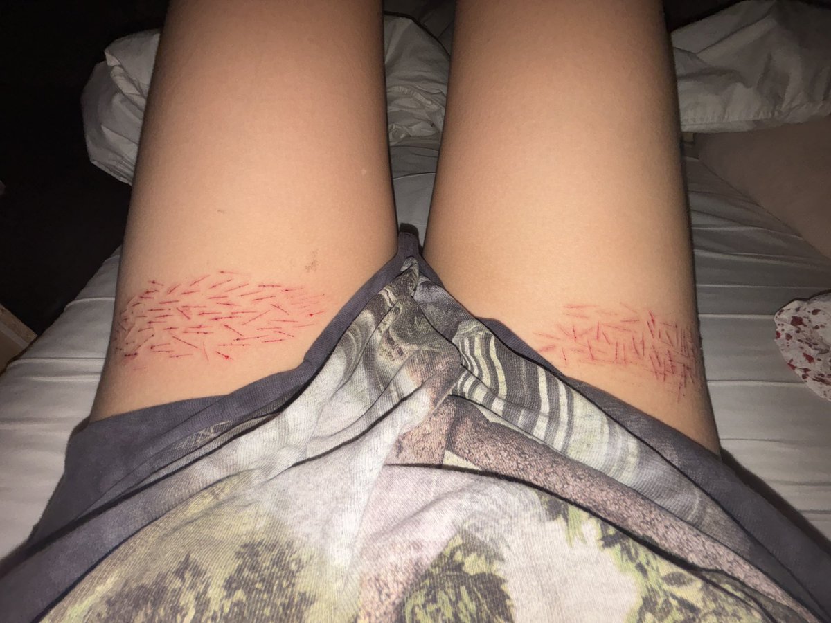 ananaririy's tweet photo. ALL FAKE NOT REAL SFX PRACTICE ON MYSELF FAKE EVERYTHING https://t.co/cR4reCuhhj