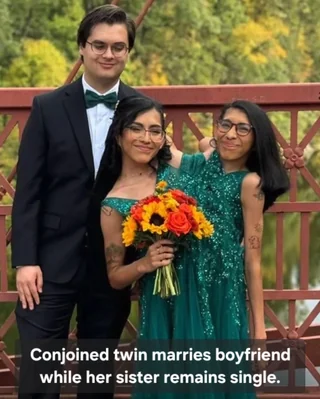 Rainmaker1973's tweet photo. Carmen Andrade, a conjoined twin, legally married her longtime boyfriend, Daniel McCormack, while her twin sister, Lupita, happily remains single. https://t.co/JWg3PLYwz7