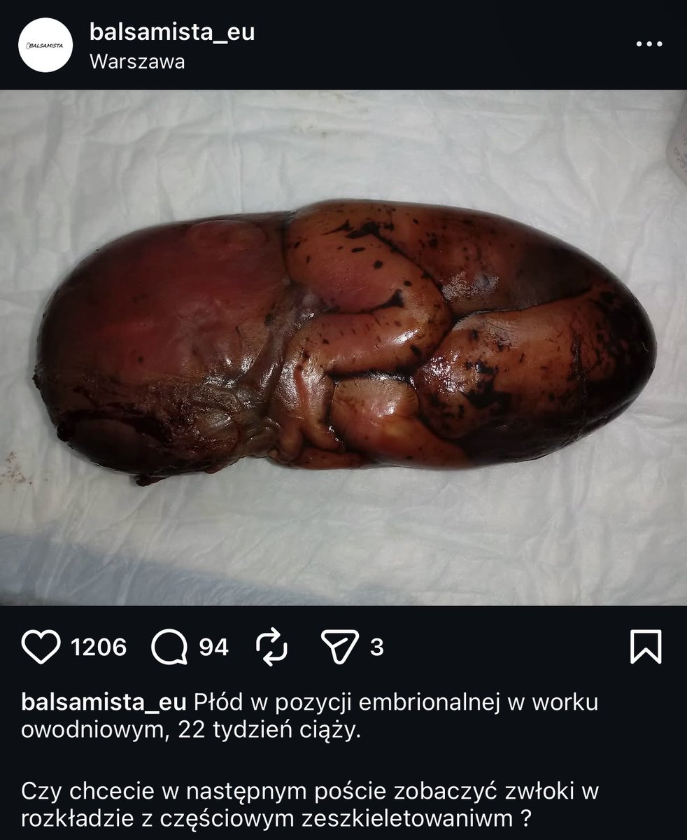 krecikkrol's tweet photo. hej @trzaskowski_ choć popatrzysz https://t.co/hUbegg0LaJ