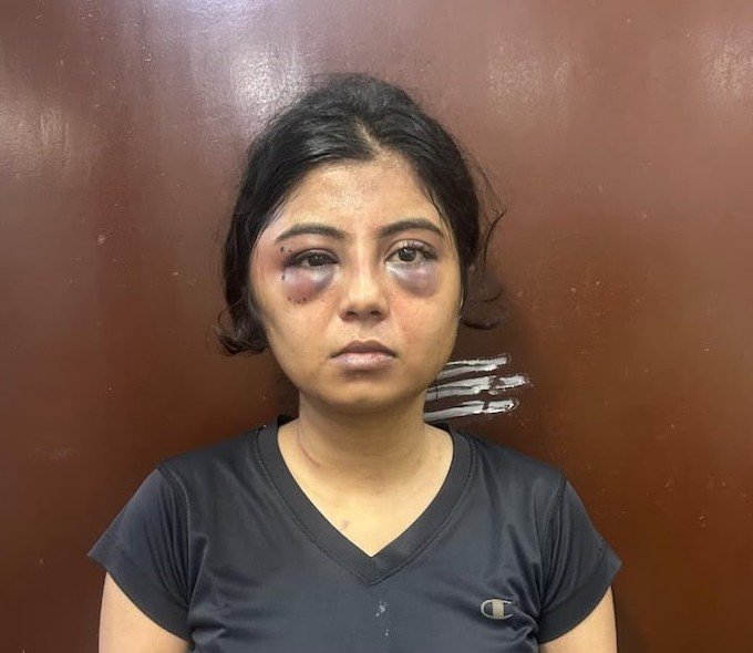 Delhiite_'s tweet photo. Physiotherapist Found Dead at Homestay; Family Alleges Abuse, Drugs and Assault

📍 Chikkaballapur, Karnataka

▪️Physiotherapist, Sai Surabhi (26) was found dead in a locked homestay.
▪️Her boyfriend, Sanjeeth Ali, was found unconscious and hospitalised.

▪️Surabhi's family alleged he assaulted her, forced her into drugs and alcohol and abused her.
 ▪️Police recovered a rope, tablets and a diary. The exact cause of death is under investigation, murder case registered.