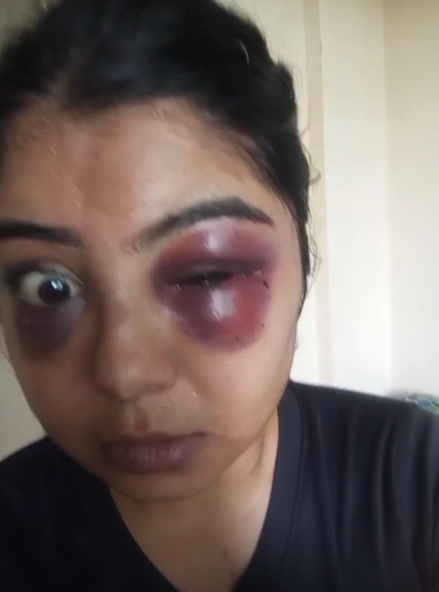 Delhiite_'s tweet photo. Physiotherapist Found Dead at Homestay; Family Alleges Abuse, Drugs and Assault

📍 Chikkaballapur, Karnataka

▪️Physiotherapist, Sai Surabhi (26) was found dead in a locked homestay.
▪️Her boyfriend, Sanjeeth Ali, was found unconscious and hospitalised.

▪️Surabhi's family alleged he assaulted her, forced her into drugs and alcohol and abused her.
 ▪️Police recovered a rope, tablets and a diary. The exact cause of death is under investigation, murder case registered.