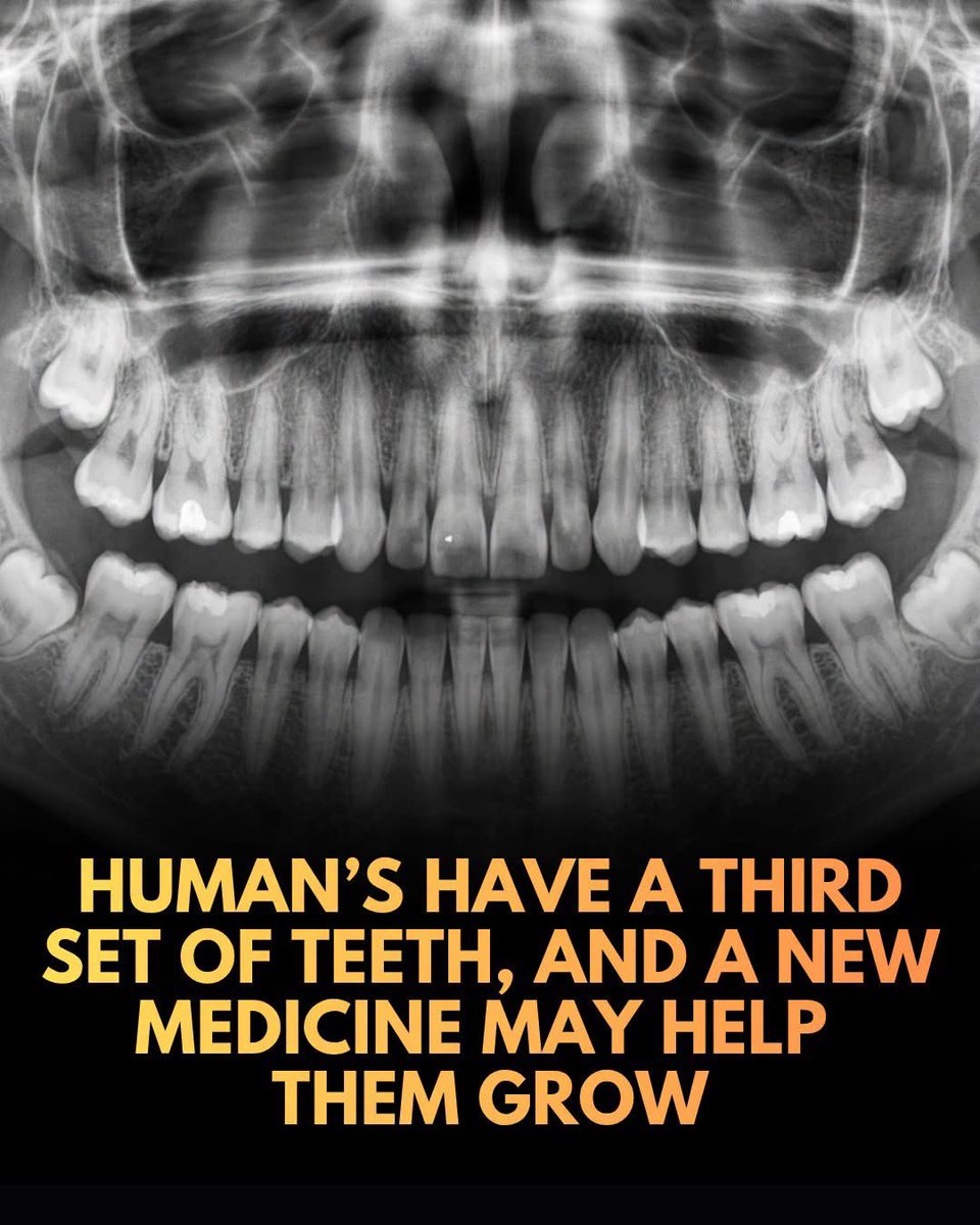 argosaki's tweet photo. Forget implants or dentures: 
a new therapy has cleared its first safety trial on a quest to regrow human teeth by 2030.

For generations, losing a permanent tooth meant relying on artificial replacements like bridges, dentures, or dental implants. 
However, a Japanese pharmaceutical startup called Toregem BioPharma is trying to change that by tapping into humans' latent biological potential to grow a third set of teeth. 

Led by Dr. Katsu Takahashi, researchers have developed TRG035, a monoclonal antibody drug that blocks USAG-1—a protein that acts as a natural brake on tooth development. 

Having already successfully regrown teeth in animal models, the company recently completed its Phase I clinical trial in Japan, testing the drug's safety in thirty healthy adult men missing at least one molar.

While the safety trial marks a major milestone, proving the drug can actually trigger the eruption of fully functional, properly aligned human teeth remains the ultimate hurdle. 
Backed by over $29 million in funding, Toregem is preparing for Phase II trials and eyeing future development in the United States, targeting an initial release by 2030. 

The treatment will first focus on patients with congenital tooth agenesis—a rare condition where people are born missing multiple permanent teeth. 
If successful, this therapy could completely redefine restorative dentistry, offering a natural biological alternative to titanium and porcelain.

source: Newcomb, T. (2026). Humans Have a Third Set of Teeth. New Medicine May Help Them Grow. Popular Mechanics.