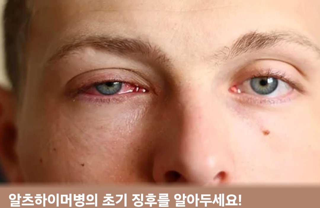 BADbyMJ's tweet photo. 아니개웃기네 https://t.co/2IHnZNorvm