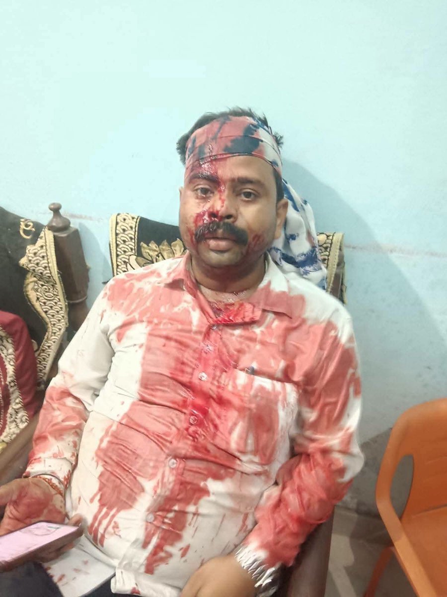 naveenpandey757's tweet photo. @Uppolice @dgpup @DcpVns @varanasipolice
जनपद -वराणसी क��� चौबेपुर थानाअंतर्गत प्राणघातक हमले मे आरोपी अभियुक्तगण के खिलाफ मुoअo-346/26 में अभी तक SHO द्वारा कोई भी वैधानिक कार्यवाही नही किया जा रहा है! https://t.co/rP5DqrcoVv