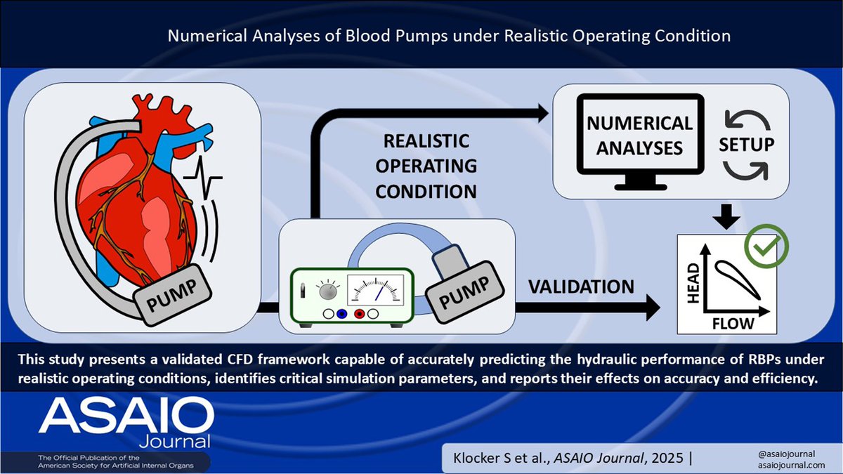 asaiojournal's tweet photo. Biomedical Engineering
Numerical Analyses of Blood Pumps Under Realistic Operating Conditions
ASAIO Journal 72(6):p 477-485, June 2026. | DOI: 10.1097/MAT.0000000000002590
https://t.co/lklZ4G3obA 
#ASAIO #HeartFailure #OpenAccess https://t.co/45CQNVmPT4