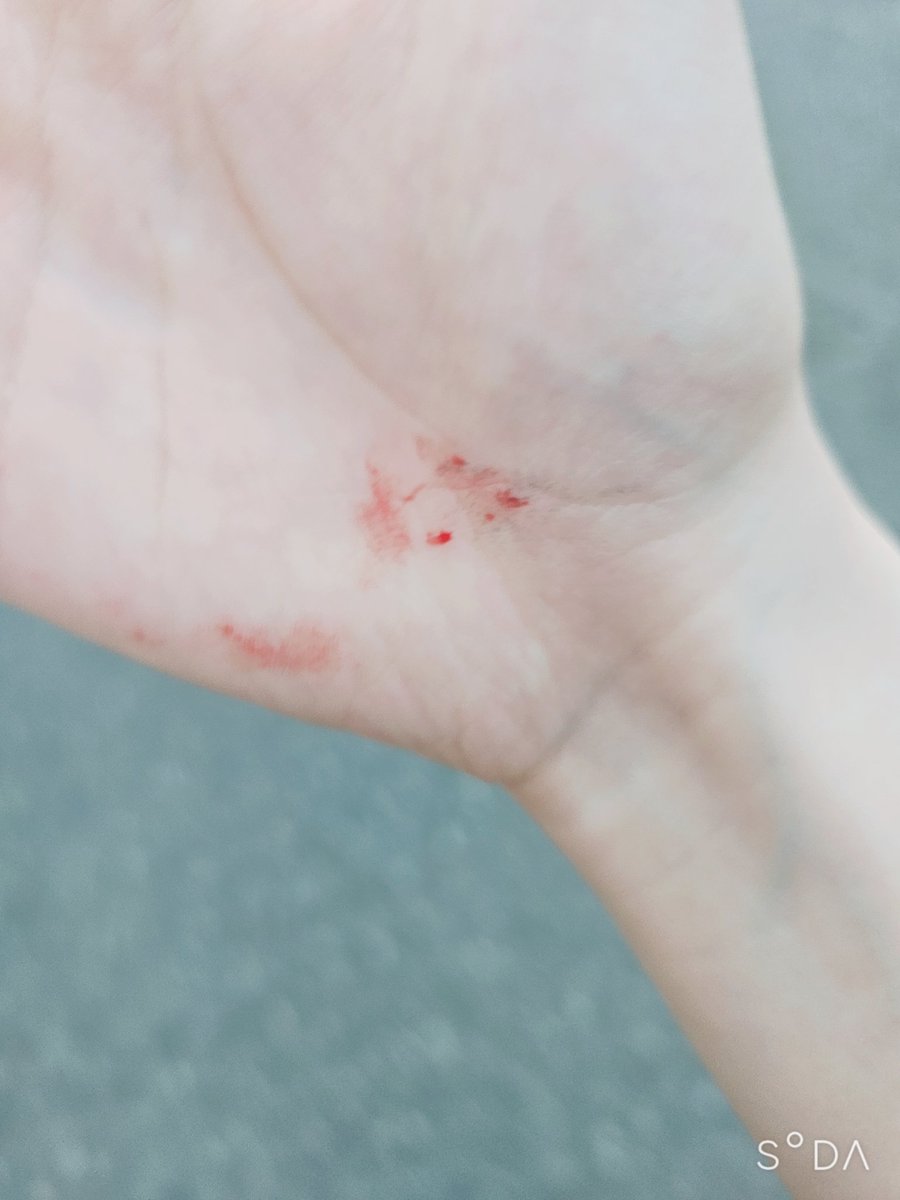 SIYU_10's tweet photo. バイ菌の運び屋潰して今これ😡 https://t.co/kED8OfkYYB