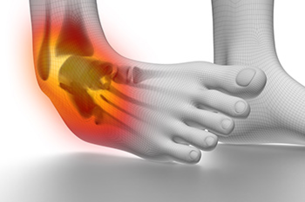 LouisMacDonald6's tweet photo. Understanding Ankle Sprains and Recovery https://t.co/QnyDEGlMi8 https://t.co/2AbCi3zp0l