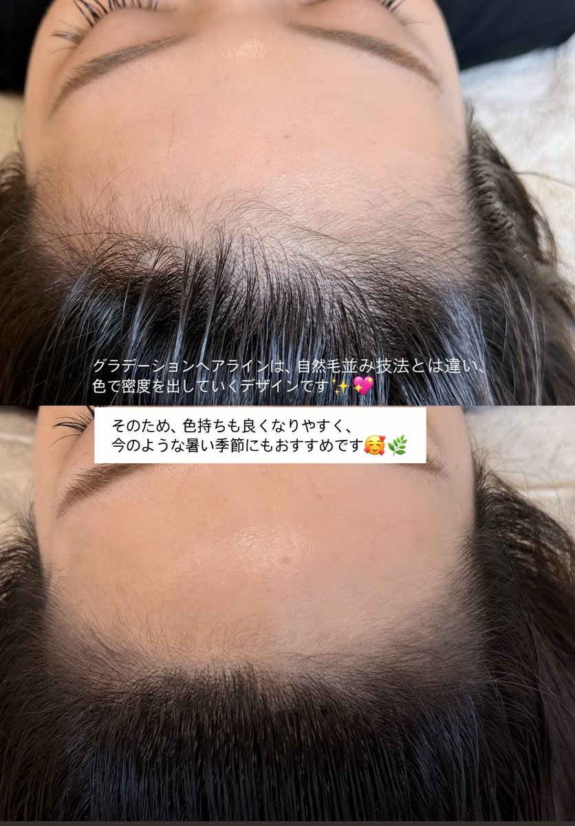 sora_artmake's tweet photo. 生え際が気になる方へ🌿

SORA ARTMAKEのグラデーションヘアラインは、
一本一本の毛を描くデザインではなく、
自然な濃淡で密度感をプラスするデザインです✨

✔ 自然な小顔効果
✔ メイクなしでもきれいな生え際
✔ 汗をかきやすい季節にもおすすめ🌞

ナチュラルな仕上がりにこだわりたい方はぜひご相談ください🤍

ご予約・お問い合わせはLINEから💌 https://t.co/dw5M21azuC

#ヘアラインアートメイク
#韓国アートメイク
#アートメイク
#韓国美容
#生え際