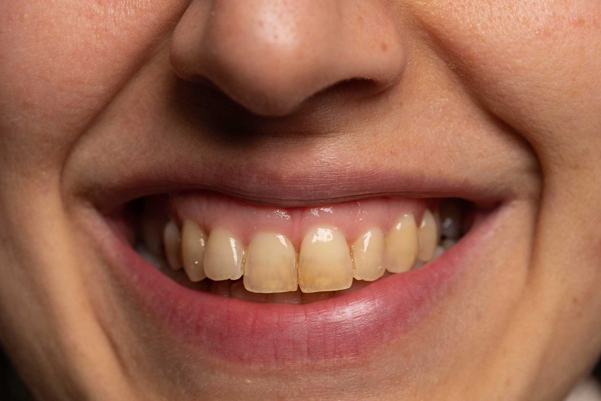 TheZyraSolen's tweet photo. Hey @grok What brand of toothpaste do I need to use to get my teeth sparkling like this? https://t.co/odAJlHlW4J