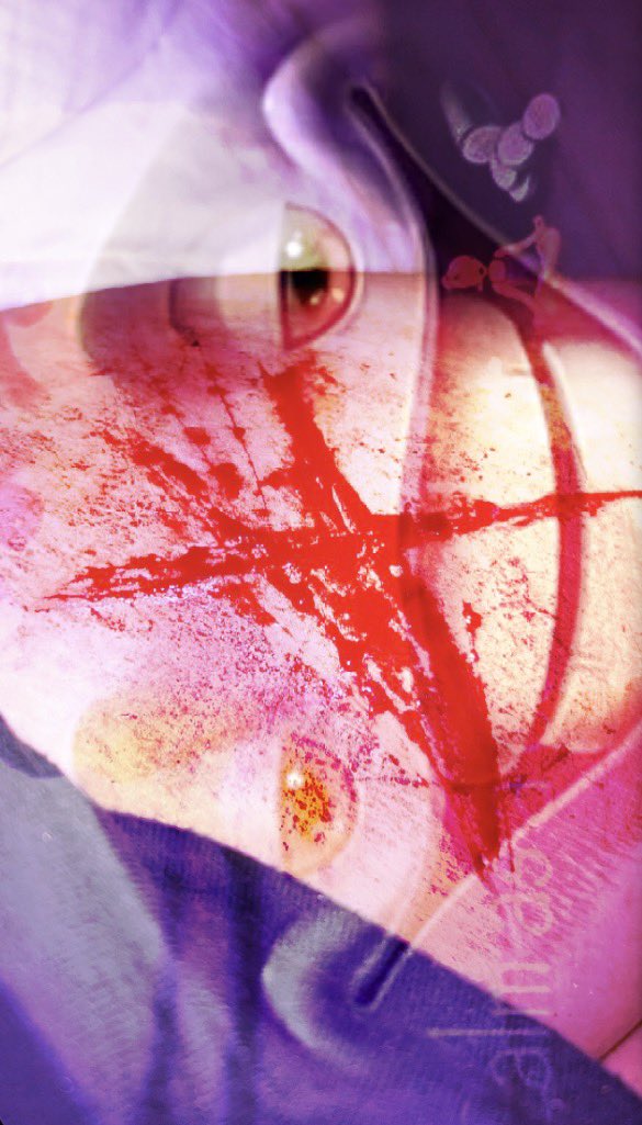 UglyPoniesEw's tweet photo. Cool little sesh today ! And uh all Ai sfx makeup ! #slittwt #scartwt #shedtwt #shtwt #goretwt #selfharm #cutspo https://t.co/n7d1p6wgW9