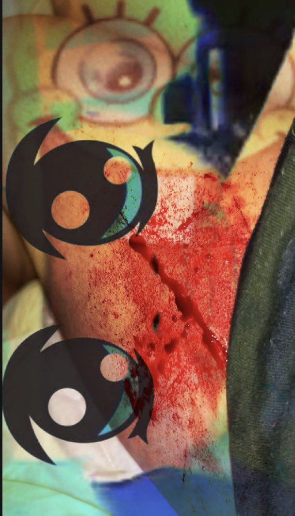 UglyPoniesEw's tweet photo. Cool little sesh today ! And uh all Ai sfx makeup ! #slittwt #scartwt #shedtwt #shtwt #goretwt #selfharm #cutspo https://t.co/n7d1p6wgW9