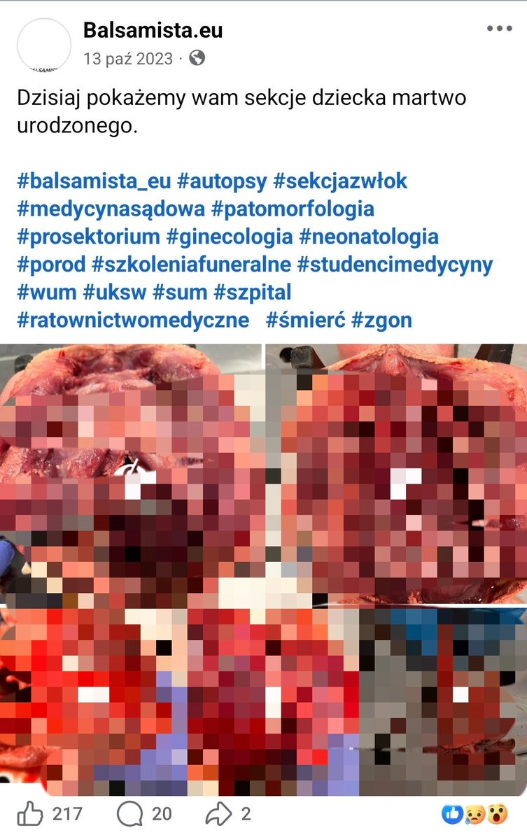 Marek_Kuna_'s tweet photo. ‼️🙈‼️

Zaraz zwymiotuję...

Im głębiej w las, tym bardziej widać patologię rządów Platformy Obywatelskiej w Warszawie przez ostatnie 20 lat‼️

A mówimy tylko o jednym miejscu - Szpital Południowy.

🤮🤮🤮🤮🤮🤮🤮🤮 https://t.co/uBqWkr7dN8