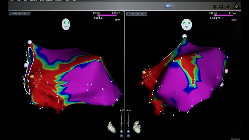 HGregorioM's tweet photo. 🫀 ¿Cómo proteger el corazón de los pacientes con cáncer?

🔬 El Marañón a través de su Fundación para la Investigación Biomédica colidera ‘COMPASS’.

✅ Un macroproyecto europeo para mejorar la calidad de vida protegiendo la salud cardiovascular.

+ Info: https://t.co/W653S4m0EF https://t.co/NXtovBnzbm