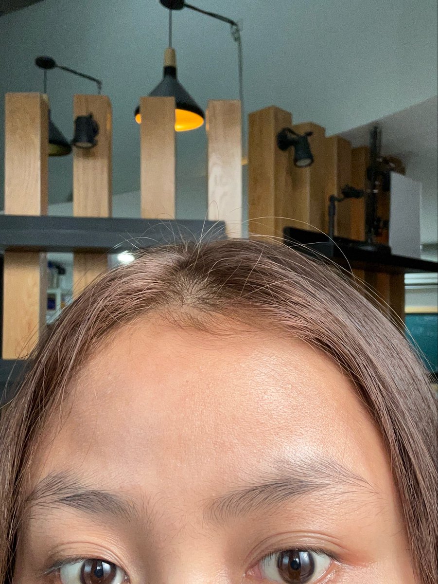 tarochococookie's tweet photo. Siapapun yang punya masalah sama rambut lagi rontok parah,tipis bahkan hampir botak, aku bakal share haircare yg aku pake dan emang sengaruh itu hasilnya! 

before                           after✨ https://t.co/1MIfLdGyPx