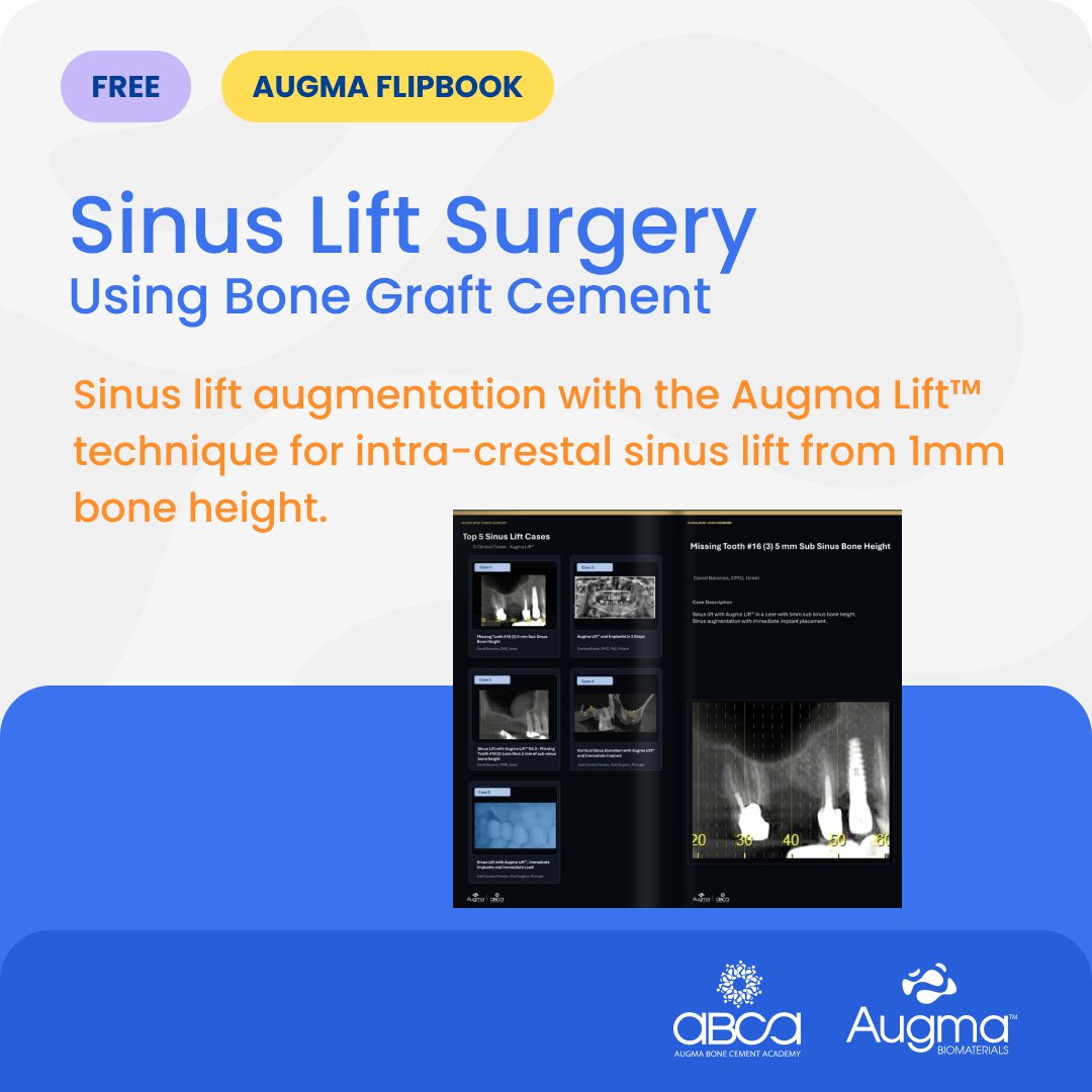 AugmaBio's tweet photo. View 5 clinical cases showcasing the minimally-invasive approach for sinus lift procedures.

For immediate access to this Flipbook place your information or click here: https://t.co/4lbZ6lUhy1 https://t.co/p44kflBOuB