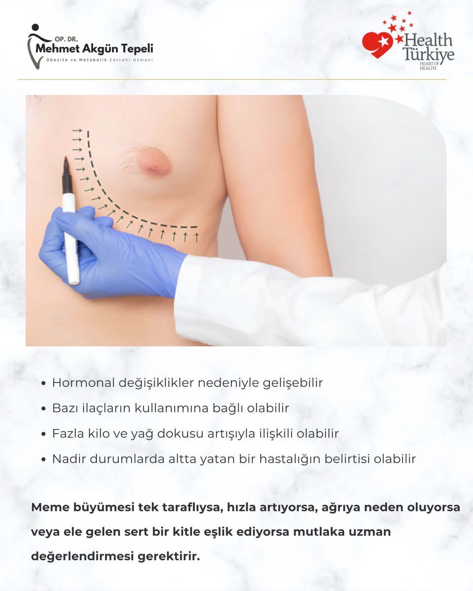 obezitehekimi's tweet photo. ❗️Her cerrahi veya girişimsel işlemde sonuçlar kişiden kişiye değişkenlik gösterebilir. İşlem öncesinde hekiminizden detaylı görüş almanız önerilir.
📞+90 532 161 43 00 / +90 530 979 43 00
💌 info@drmehmetakguntepeli.com
🌐 https://t.co/YdhqlmUXkj
#drmat #jinekomasti #estetik https://t.co/jMtvbyRTno