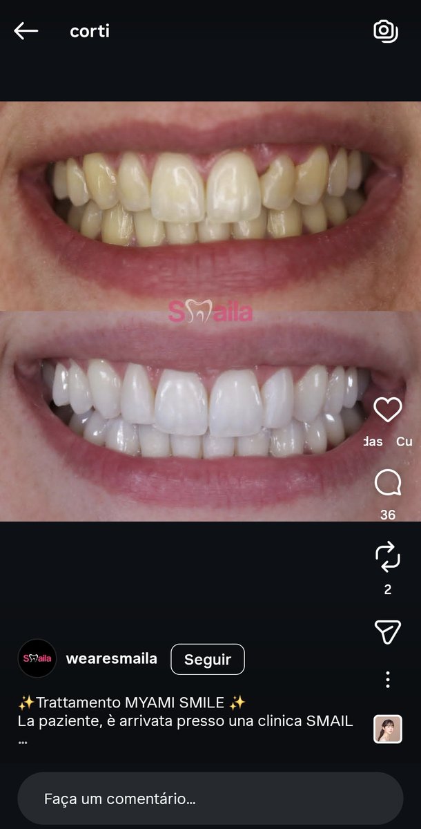 Guilhermingu's tweet photo. Pesquisei cortis no instagram e apareceu um sorriso igual o do Martin suspect https://t.co/fGXcdWjHHA