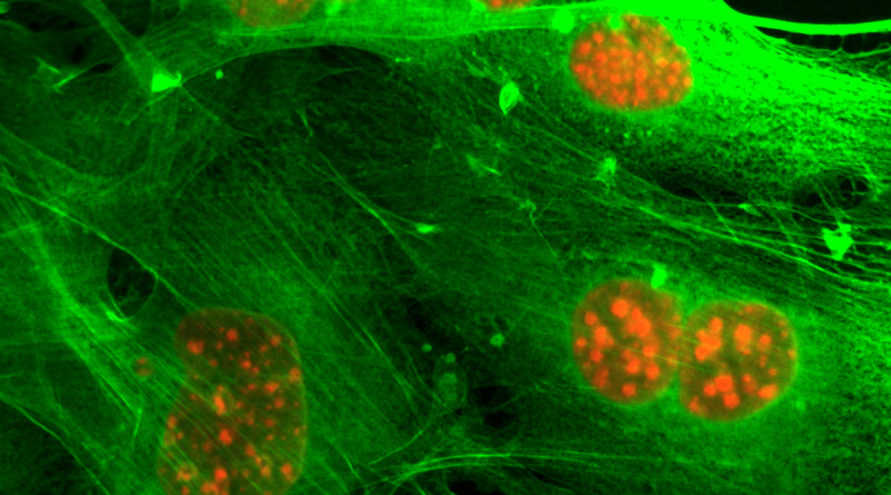 BCMFromtheLabs's tweet photo. #Neutrophis help #BreastCancerCells spread to other organs. @XiangZhangLab, L. Wu explain their findings. @CR_AACR @bcmhouston @BCMCancerCenter #BCMPostdoc #metastasis https://t.co/GeXkV0wKds