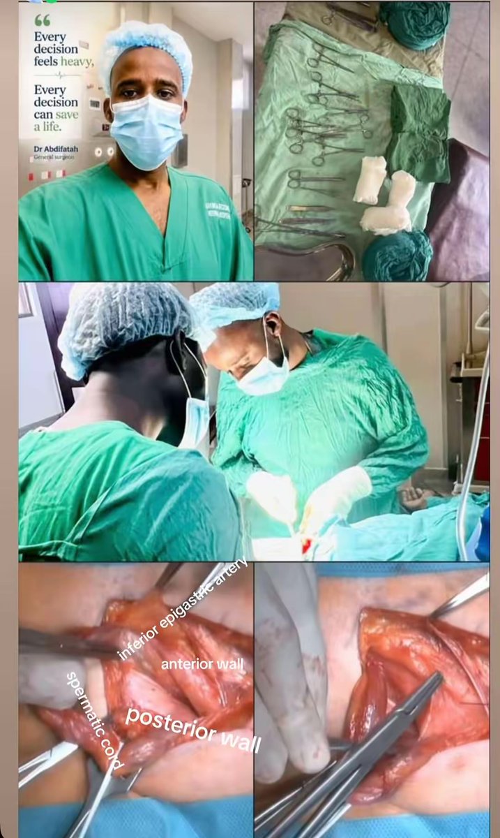 drmaash30's tweet photo. Precision in surgery begins with mastering anatomy. Every structure identified and preserved is another step toward a safer operation.
#GeneralSurgery /HerniaRepair #MedicalEducation /PatientSafety  /#LaparoscopicSurgery   

#Dr Abdifatah 
    surgeon https://t.co/JXiA9ew9dF