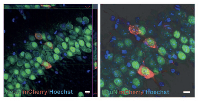_JCBFM's tweet photo. ๐จNew #HotTopic in #VascularDementia! ๐ง
๐กConverting astrocytes into neurons using viral vectors (Ptbp1 KO or SOX transduction) preserves brain structure, reduces inflammation, and boosts neuron regeneration in a mouse model.
๐ Free access (1 month): https://t.co/v1nfU1ydFo https://t.co/bqDf1rwphT