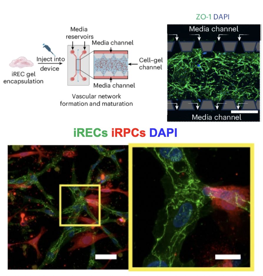 GerechtLab's tweet photo. Our latest paper is out now in Nature BME!

Co-led by Ying-Yu Lin and Parker Esswein, we developed a protocol to differentiate human induced pluripotent stem cells into retinal endothelial cells (iRECs) &amp; showcase applications.

Check it out here: https://t.co/J3Kuo91RDe https://t.co/P5dH0CLTLX