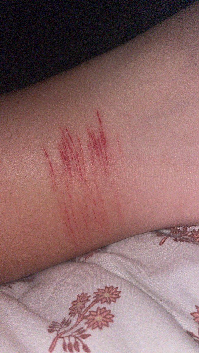 yeahidkguys123's tweet photo. Very small cat scratches on ankle sorry guys  #sh #selfharm #triggerwarning  #sesh https://t.co/p9KKbFPapY