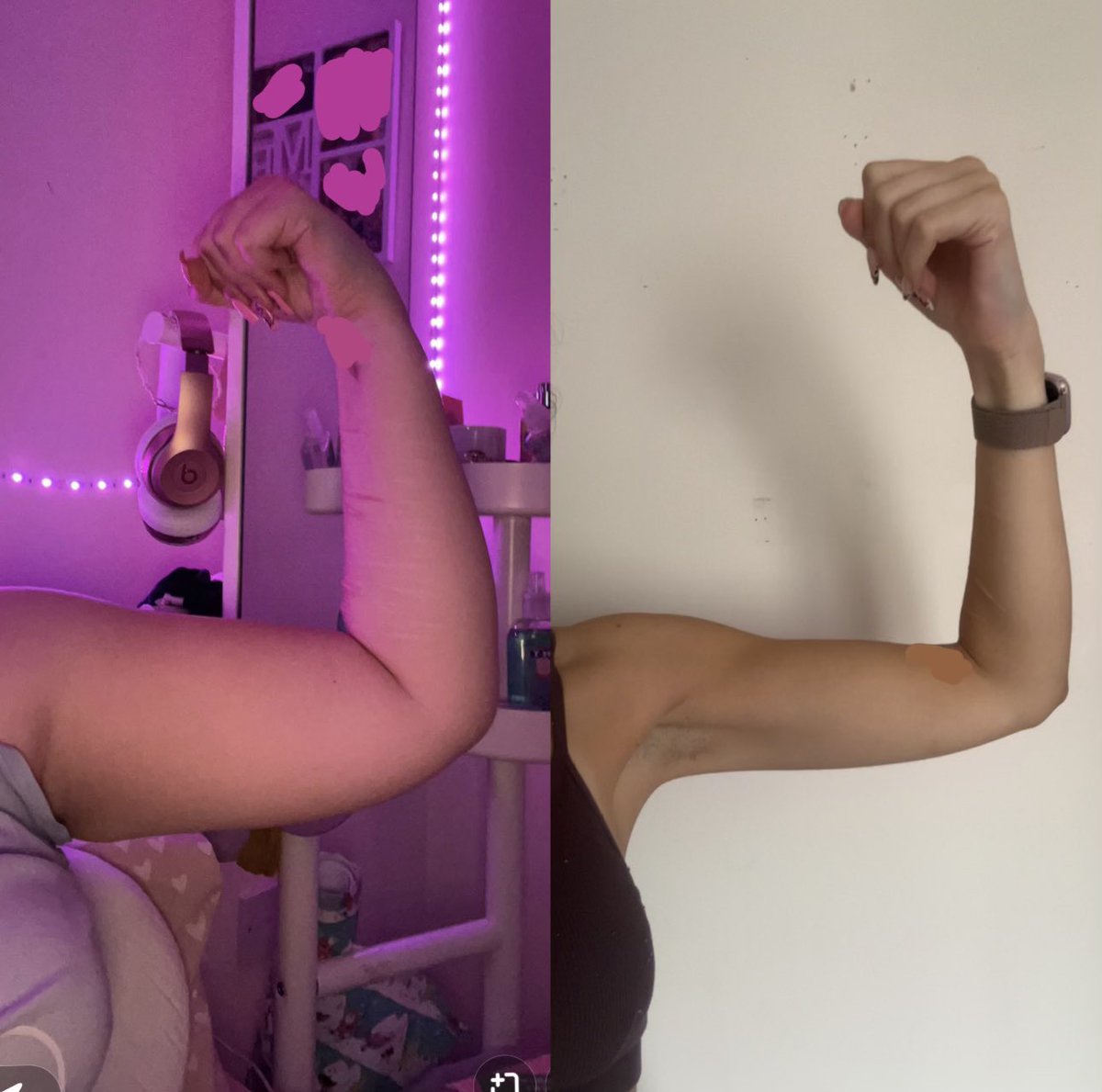 Sommershungry's tweet photo. Arm comparison https://t.co/xYtNNtoi63