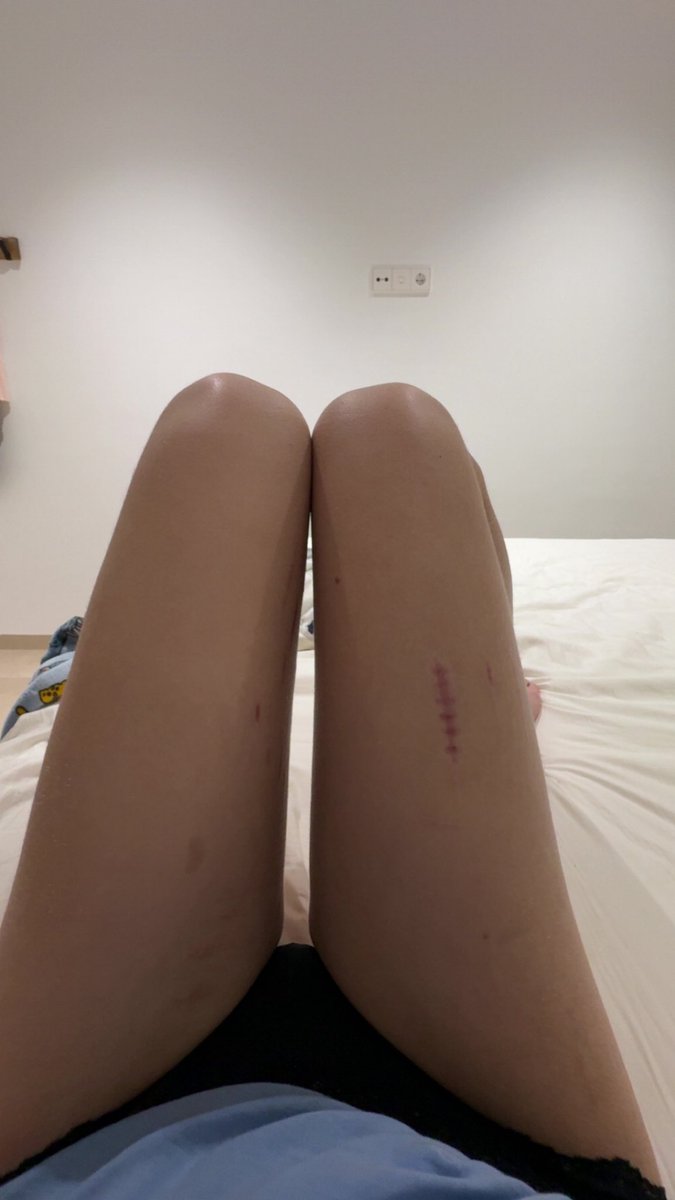 rinitoshiissoct's tweet photo. When do I get a thigh gap and smaller thighs and how? Eaten 900 cals for 5 days and atleast minnium of 12k-steps and a thigh workout everyday. Started at 49~ kg 158 cm but idk how much I weigh now https://t.co/bj1OljlDfj