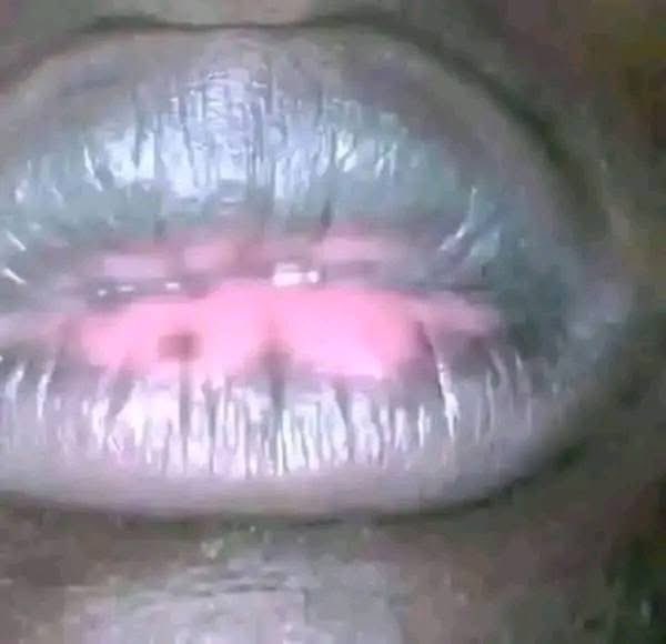Omoilorin001's tweet photo. What causes this kind of a thing? https://t.co/96W1sqeJRg