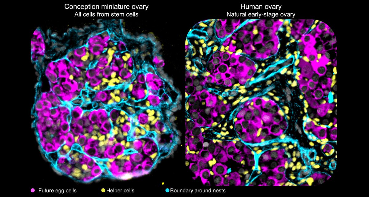 mattkrisiloff's tweet photo. After a simple blood draw, we converted blood cells into stem cells. 

From there, we coaxed those stem cells to become miniature human ovaries containing the early eggs. https://t.co/suvx7LhcwB